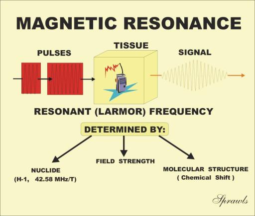 Magnetic Resonance Imaging